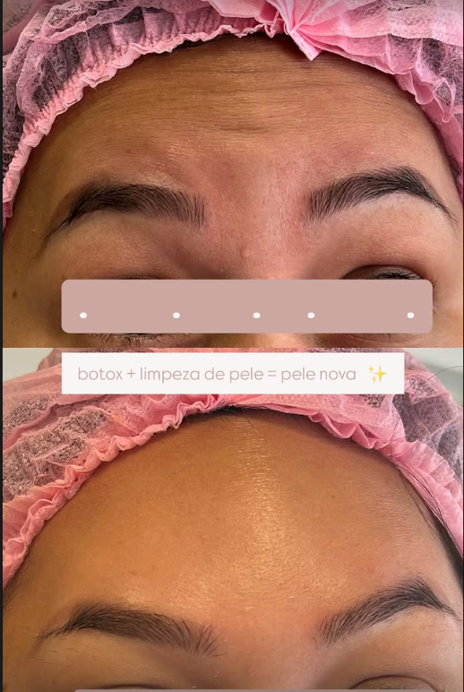 Depoimento de cliente 4